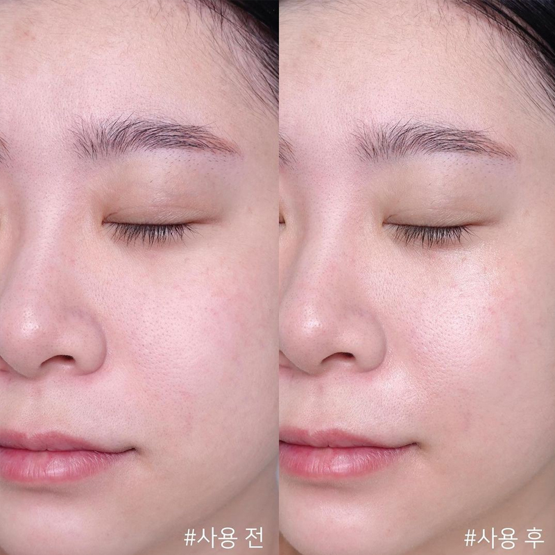 Centella Asiatica Time Reverse - огляд і ціна Centella Asiatica Toner