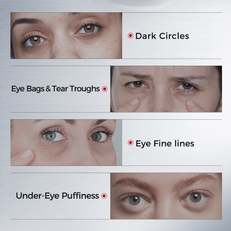 Eye Patches for Dark Circles – - огляд і ціна Collagen Sheet Mask