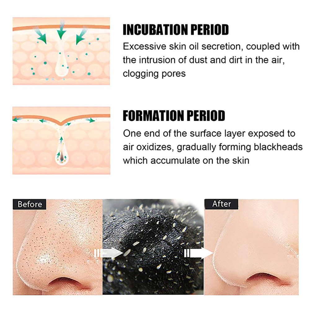 10/20/50/100 Pieces Deep Clean - огляд і ціна Charcoal Pore Strip