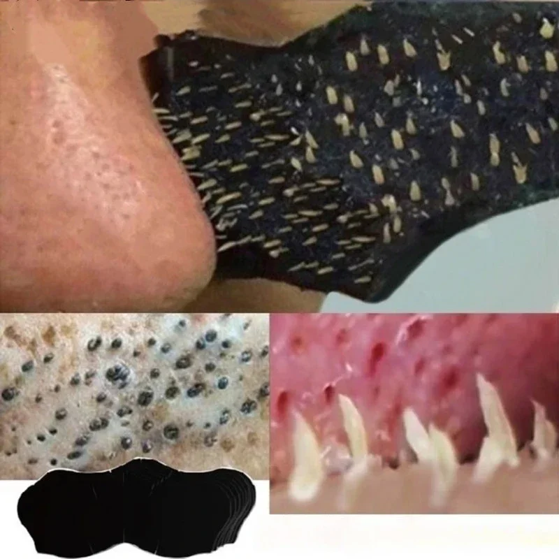 Unisex Blackhead Remove Mask N - огляд і ціна Skincare Viral Tiktok