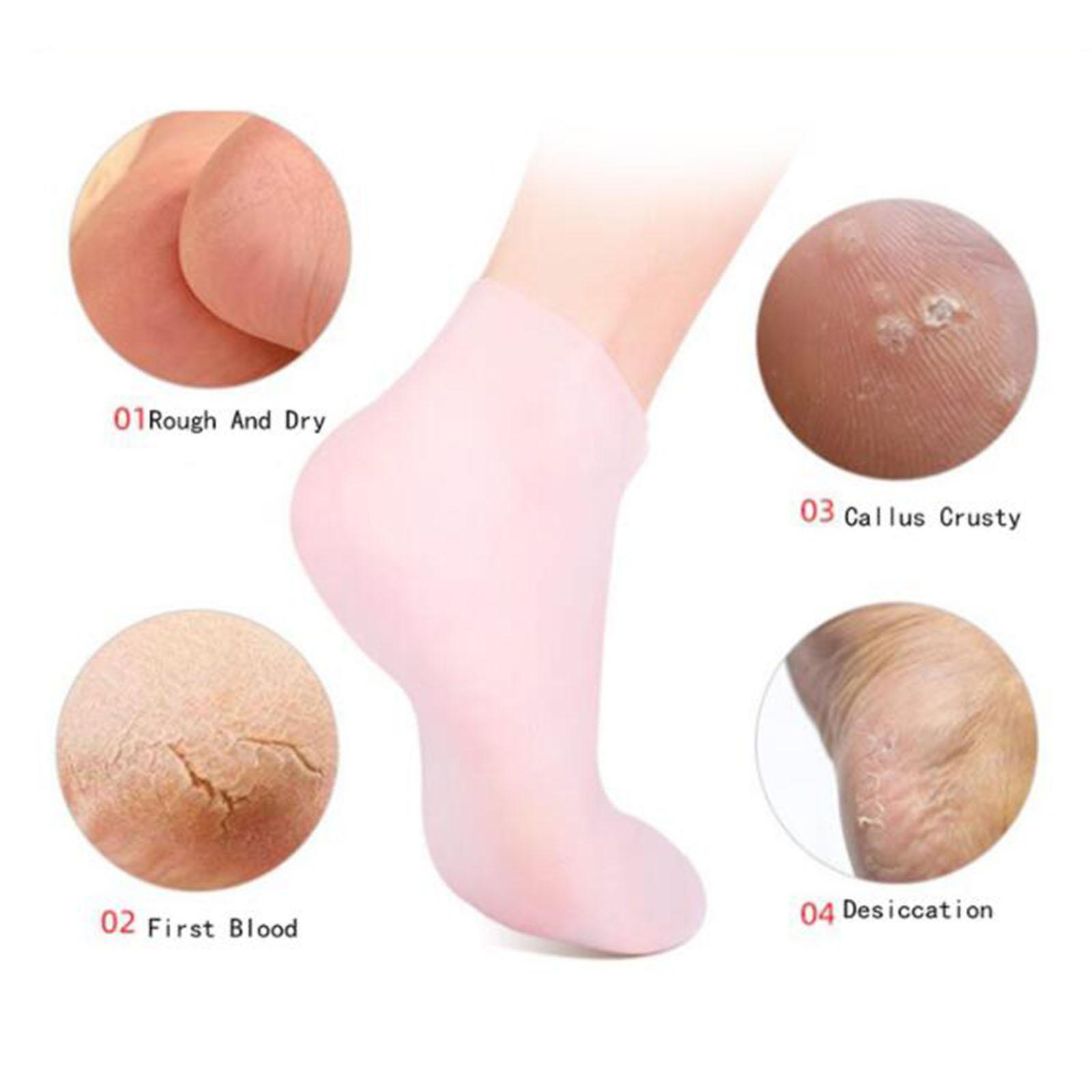 Soft Silicone Gel Socks Toe So - огляд і ціна Xl Skincare