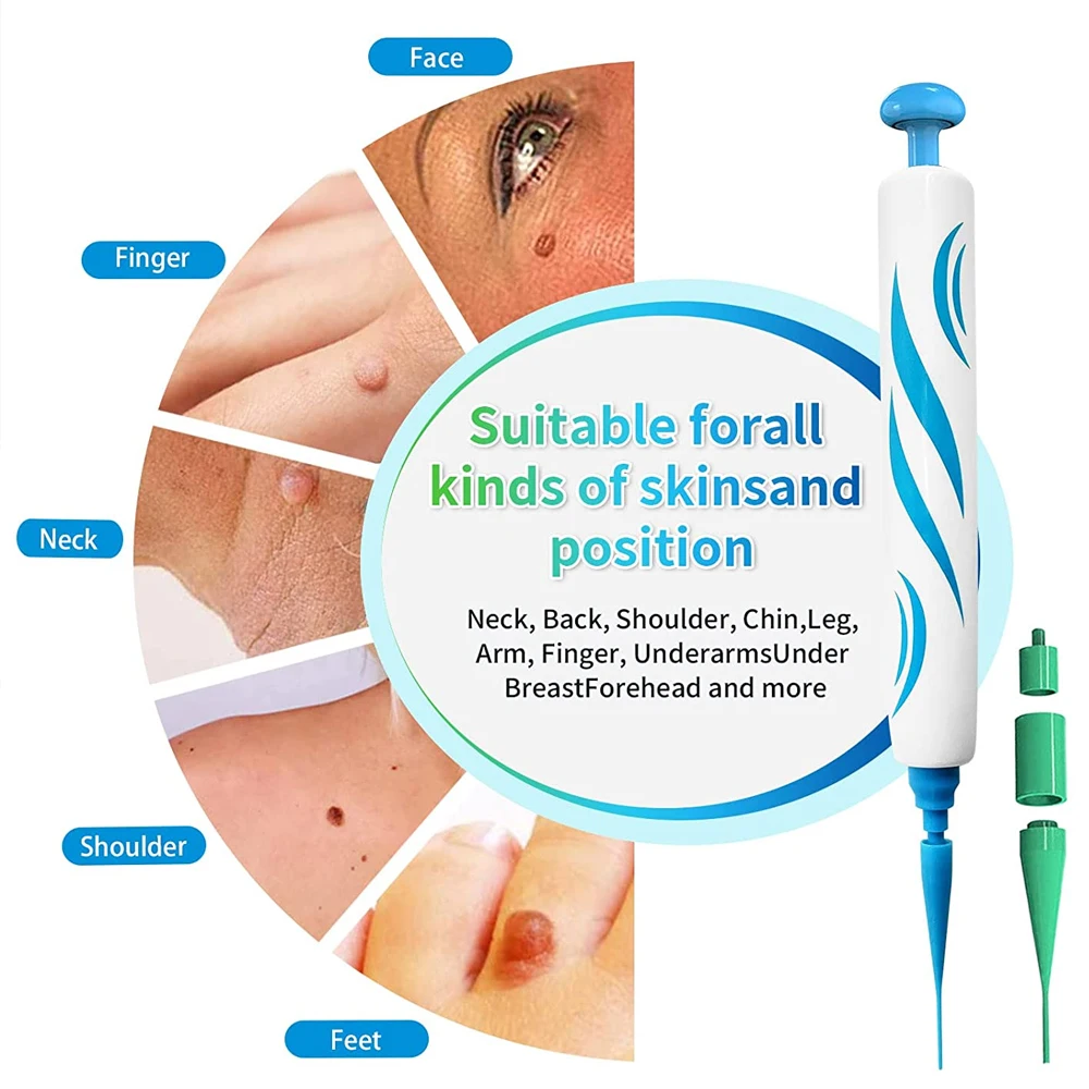 2 IN 1 Auto Micro Skin Tag Rem - огляд і ціна Skincare Ingredients Checker