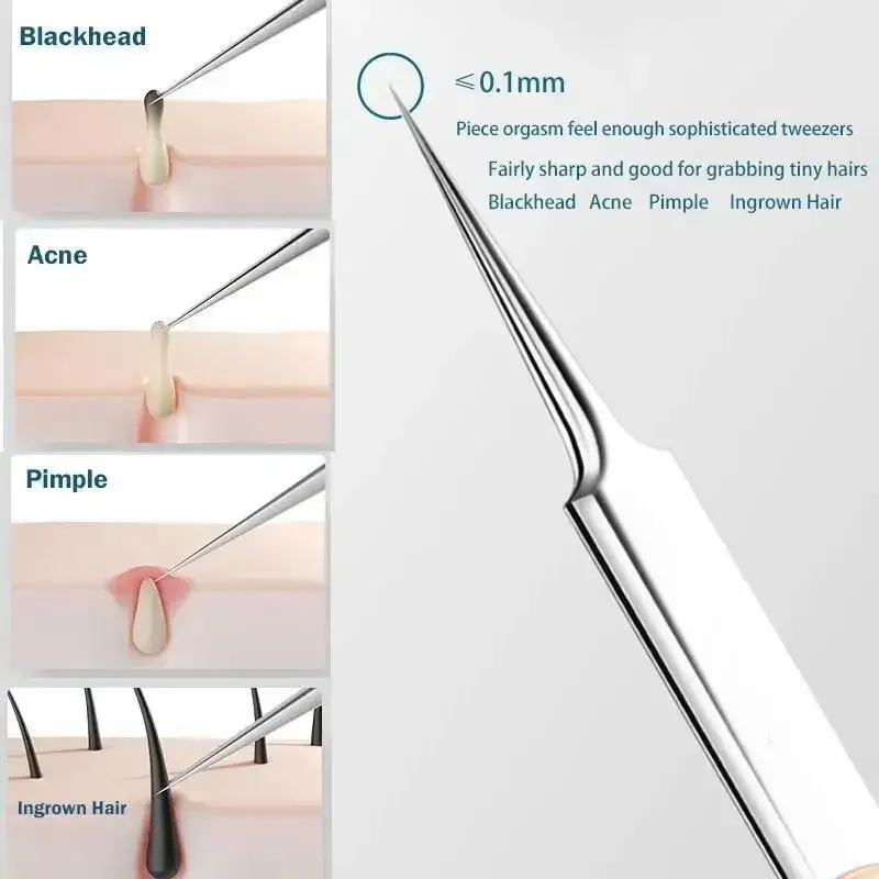 11Pcs/Set Acne Needle Blackhea - огляд і ціна Skincare Ingredients Checker