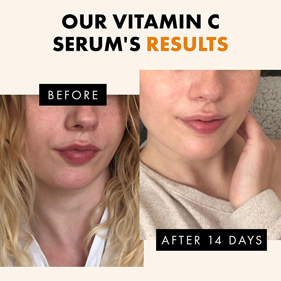 120ml 99% Vitamin C Serum Oil  - огляд і ціна Snail Mucin Essence
